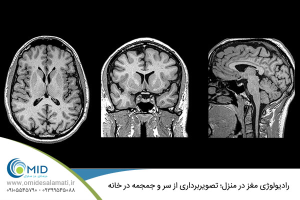 رادیولوژی مغز در منزل