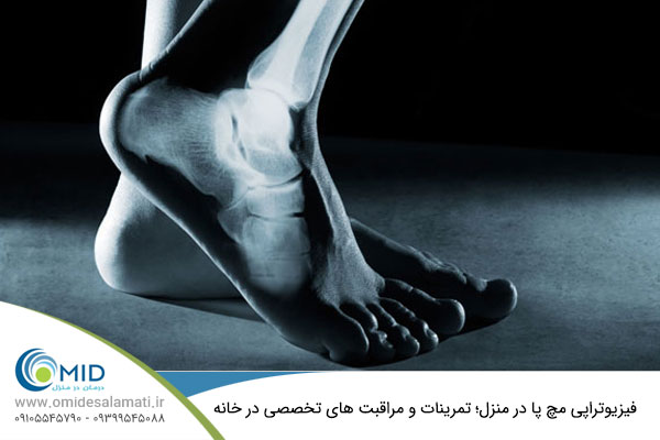 فیزیوتراپی مچ پا در منزل