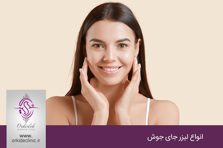 لیزر جای جوش