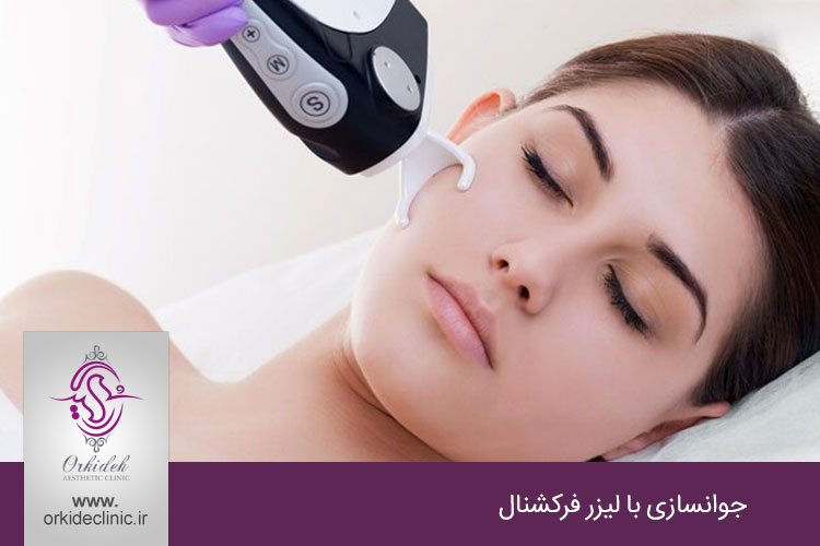 جوانسازی با لیزر فرکشنال
