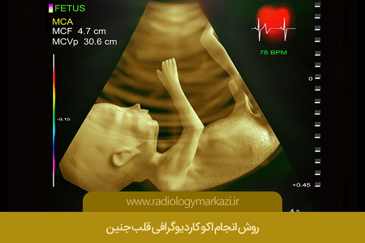 اکوکاردیوگرافی قلب جنین