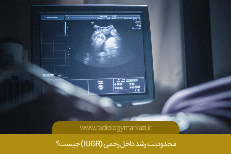 سونوگرافی IUGR در اصفهان