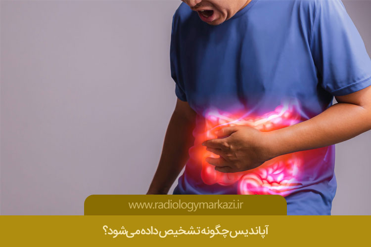 آپاندیس چگونه تشخیص داده می‌شود؟