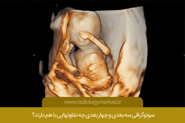 سونوگرافی سه بعدی