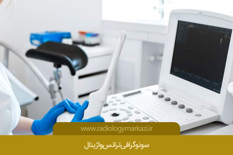 سونوگرافی ترانس واژینال