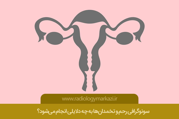 دلایل انجام سونوگرافی رحم و تخمدان
