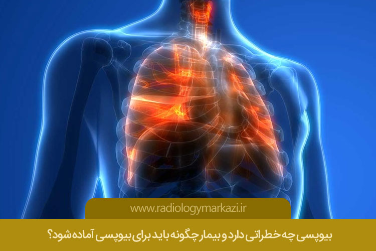 بیوپسی چه خطراتی دارد