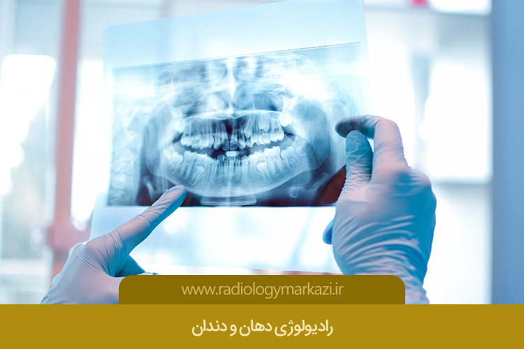 آشنایی با رادیولوژی دهان و دندان