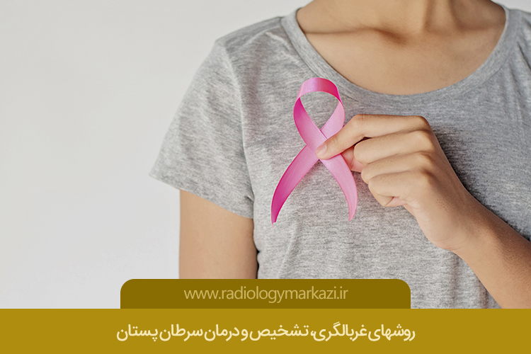  سرطان پستان