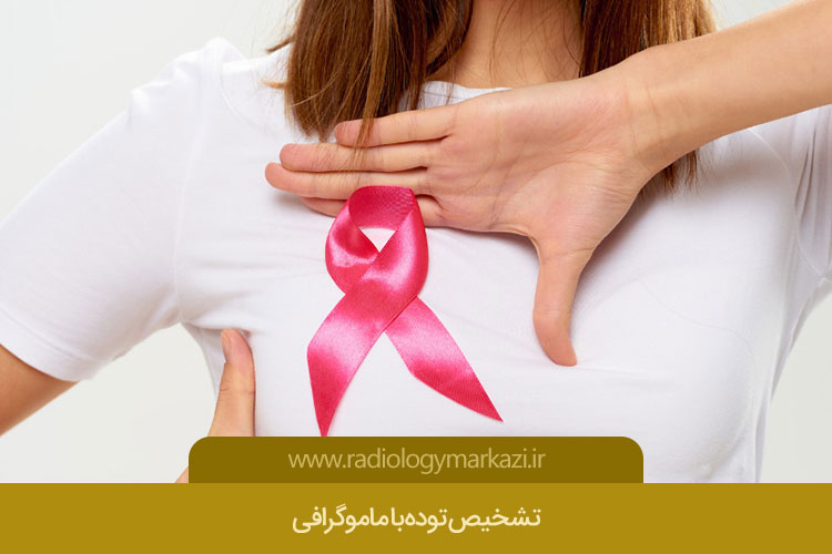 تشخیص توده با ماموگرافی 