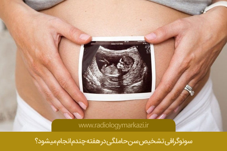 محاسبه سن بارداری با سونوگرافی