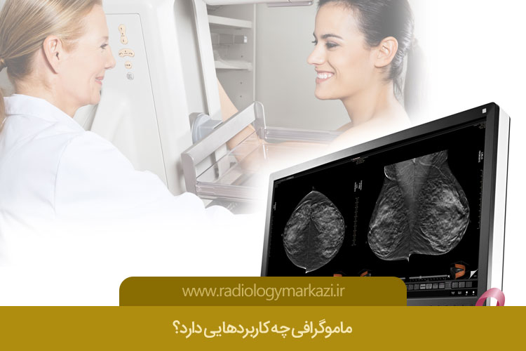 ماموگرافی چه کاربردهایی دارد