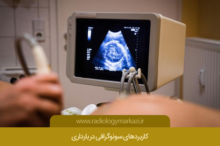 کاربردهای سونوگرافی در بارداری