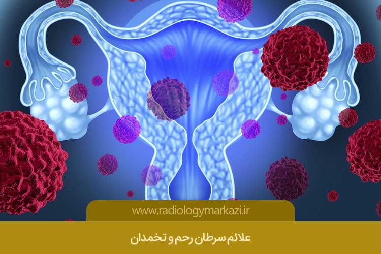 علائم سرطان رحم و تخمدان