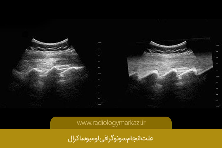  سونوگرافی لومبوساکرال