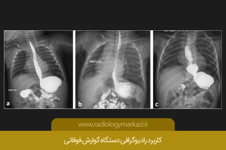 رادیوگرافی دستگاه گوارش