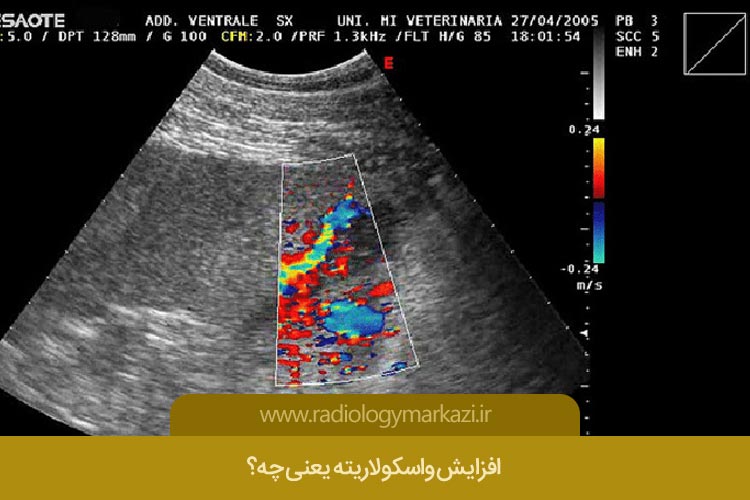 افزایش واسکولاریته