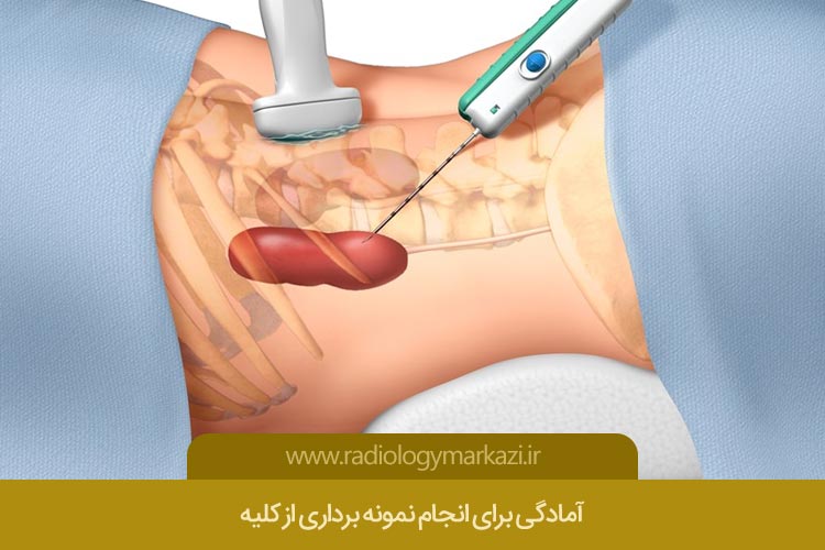 آمادگی برای انجام نمونه برداری از کلیه