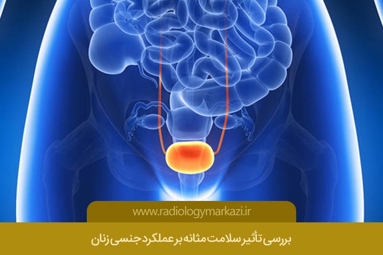 بررسی تأثیر سلامت مثانه بر عملکرد جنسی زنان