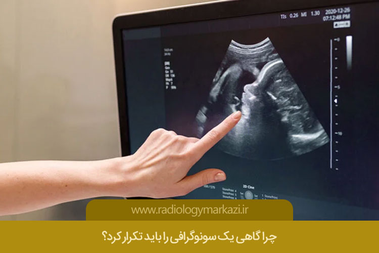 علت تکرار سونوگرافی