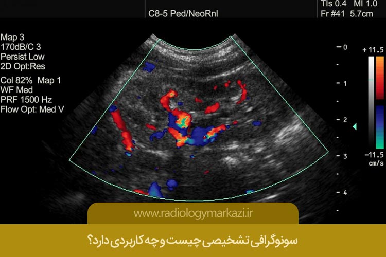 سونوگرافی تشخیصی