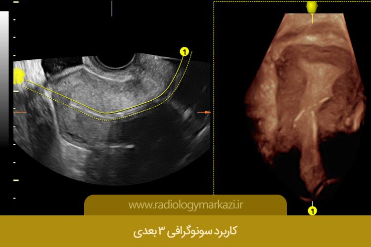 کاربرد سونوگرافی