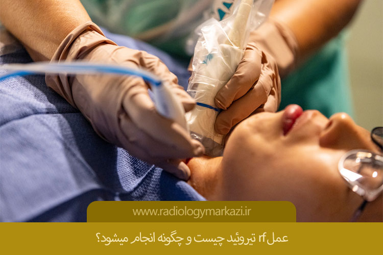 آر اف تیروئید