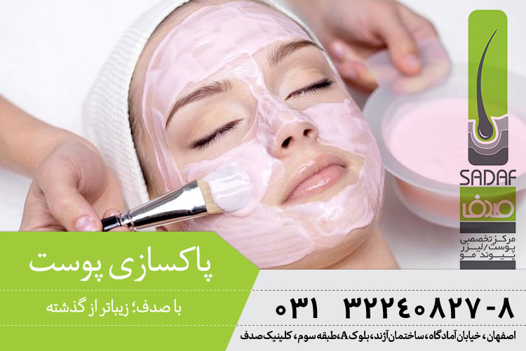 پاکسازی و لایه برداری پوست در اصفهان