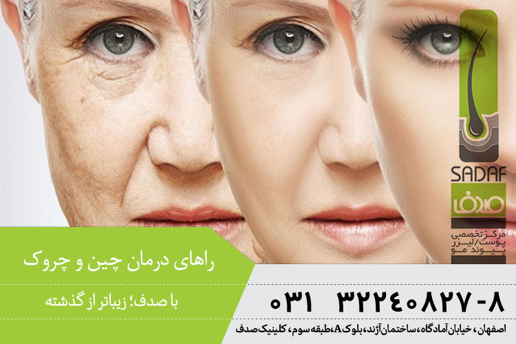 بهترین درمان چین و چروک در اصفهان