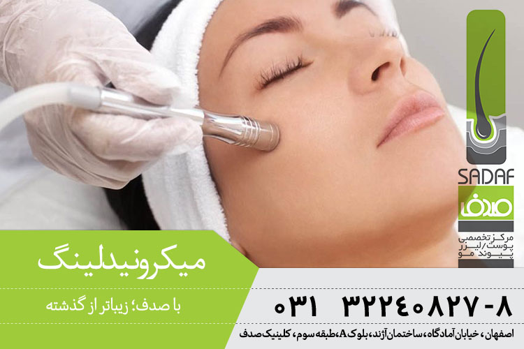 میکرونیدلینگ در اصفهان