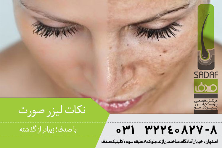 لیزر درمانی پوست در اصفهان