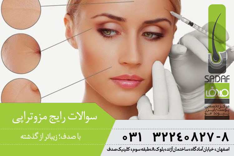 سوالات رایج مزوتراپی در اصفهان