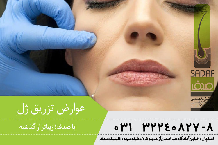 همه چیز درباره تزریق ژل در اصفهان