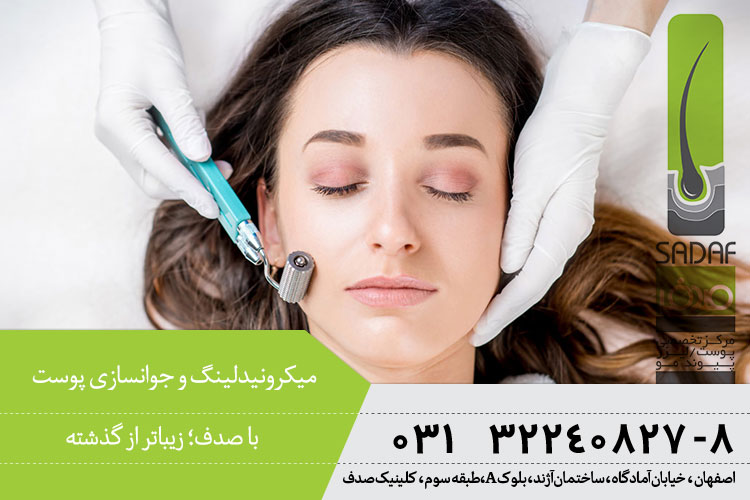 میکرونیدلینک و جوانسازی در اصفهان