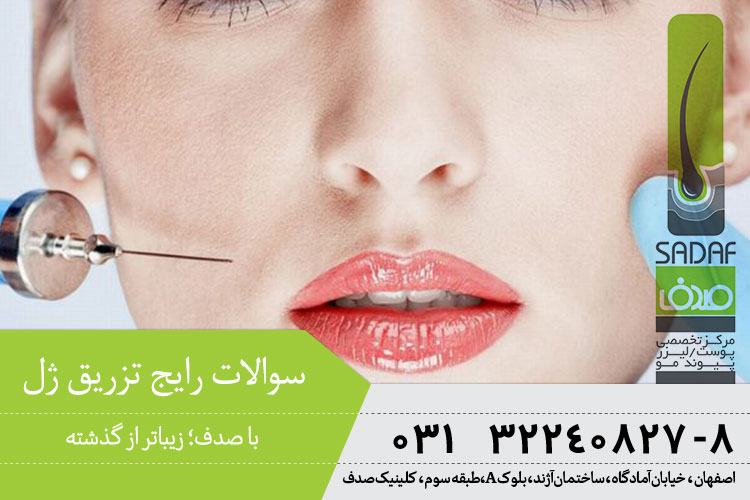 تزریق ژل در کلینیک پوست صدف اصفهان