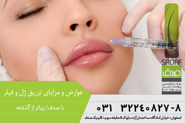 بهترین تزریق ژل و فیلر در اصفهان