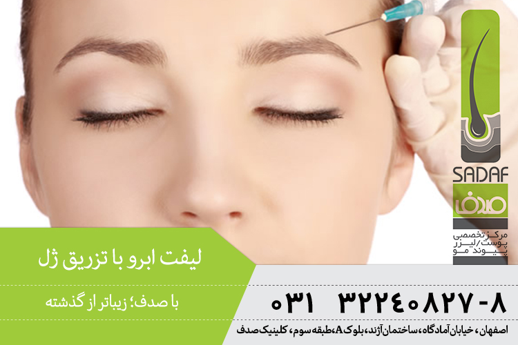 بهترین تزریق ژل ابرو در اصفهان