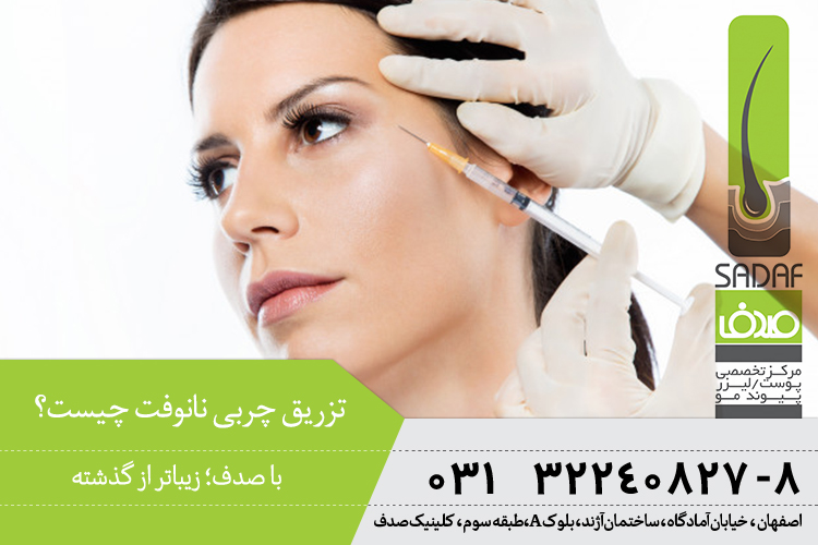 بهترین تزریق چربی نانوفت در اصفهان