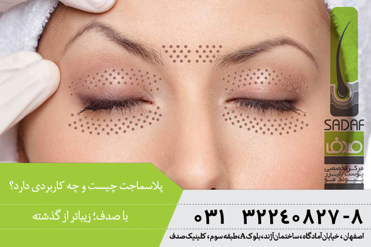 بهترین پلاسماجت در اصفهان