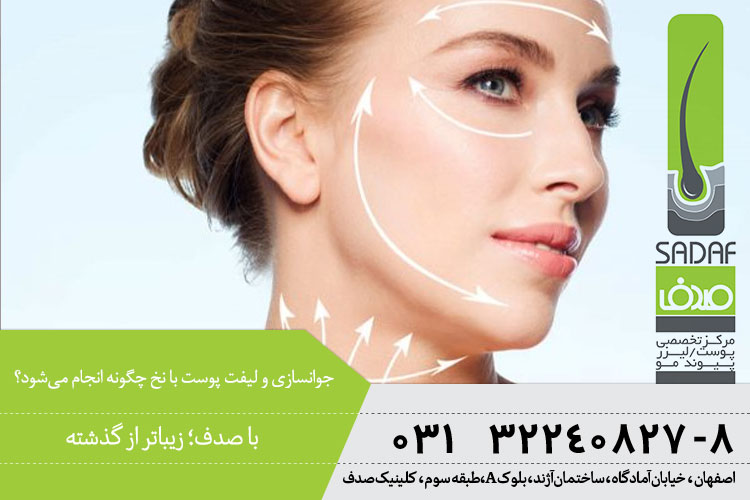 جوانسازی و لیفت پوست با نخ چگونه انجام میشود؟