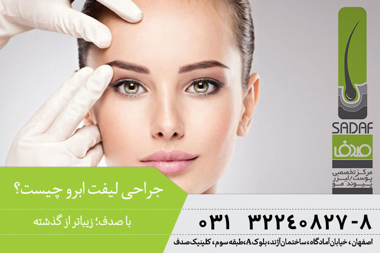 جراحی لیفت ابرو | ماندگاری لیفت ابرو با جراحی