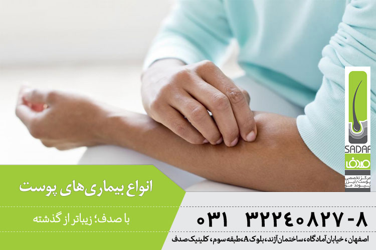 انواع بیماری های پوستی