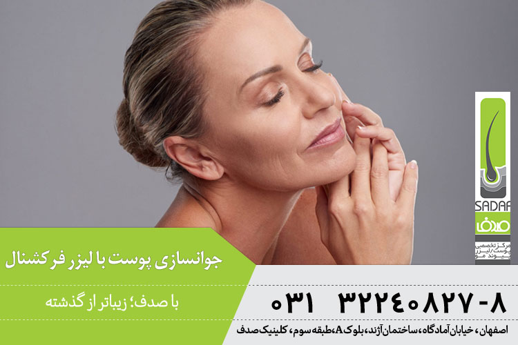 کاربرد و مزایای لیزر فرکشنال