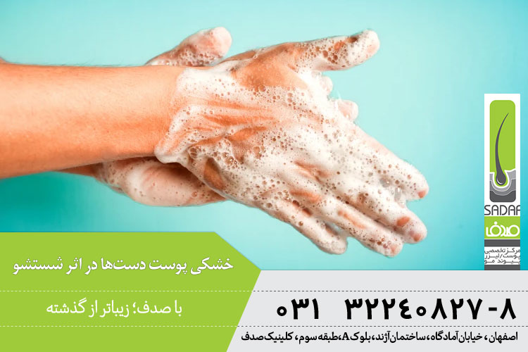 جلوگیری از خشکی پوست دست