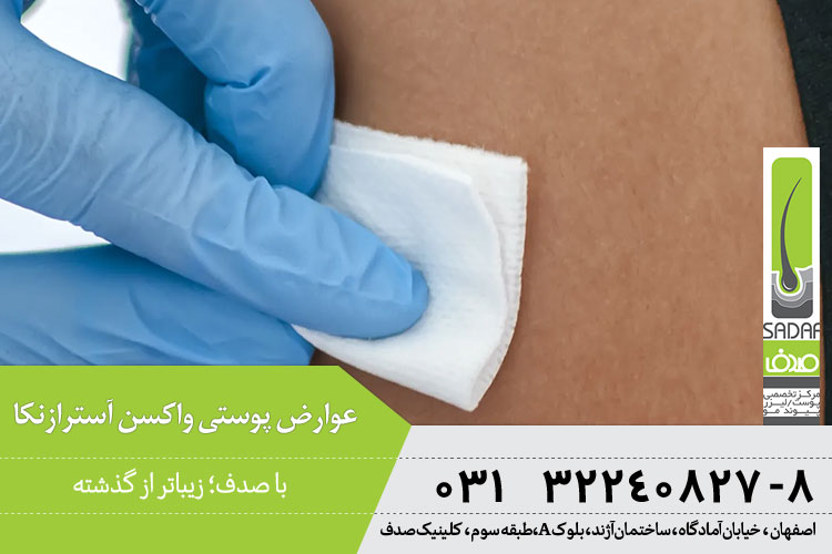 عوارض پوستی واکسن آسترازنکا