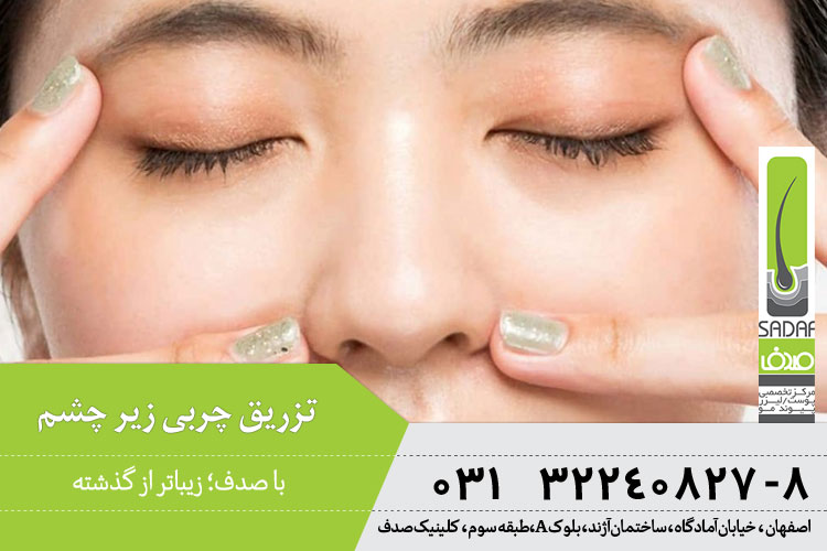 تزریق چربی زیر چشم 