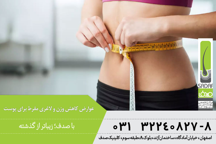 عوارض کاهش وزن و لاغری مفرط برای پوست