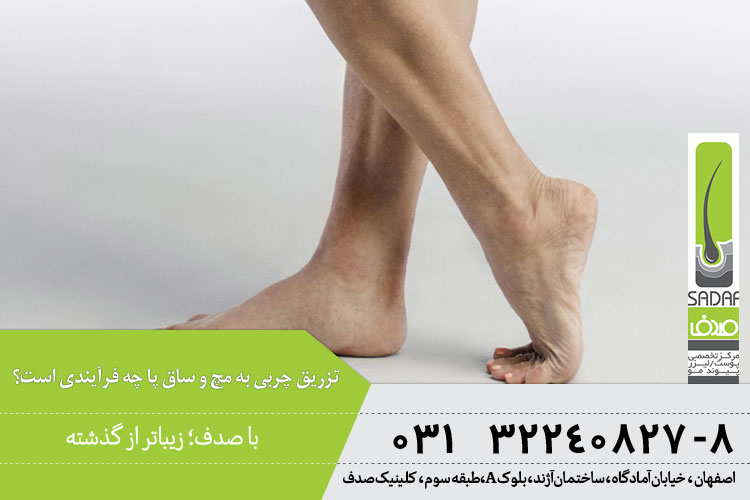 تزریق چربی به مچ و ساق پا