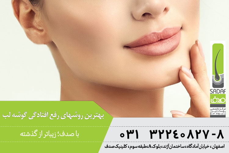 روشهای رفع افتادگی گوشه لب