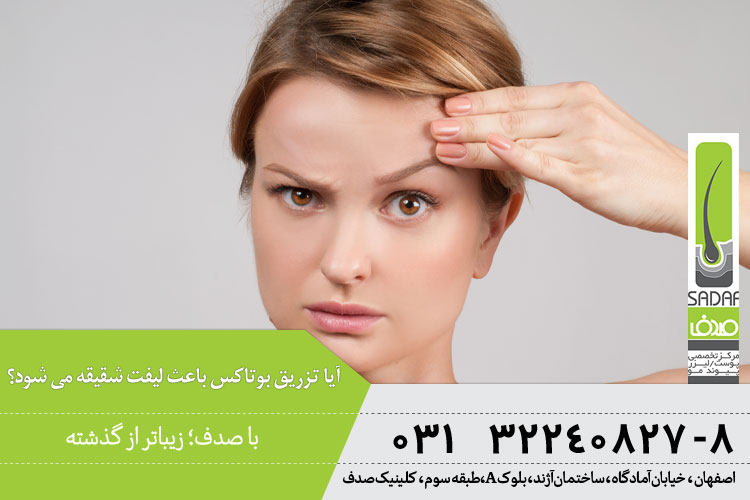 لیفت شقیقه با تزریق بوتاکس